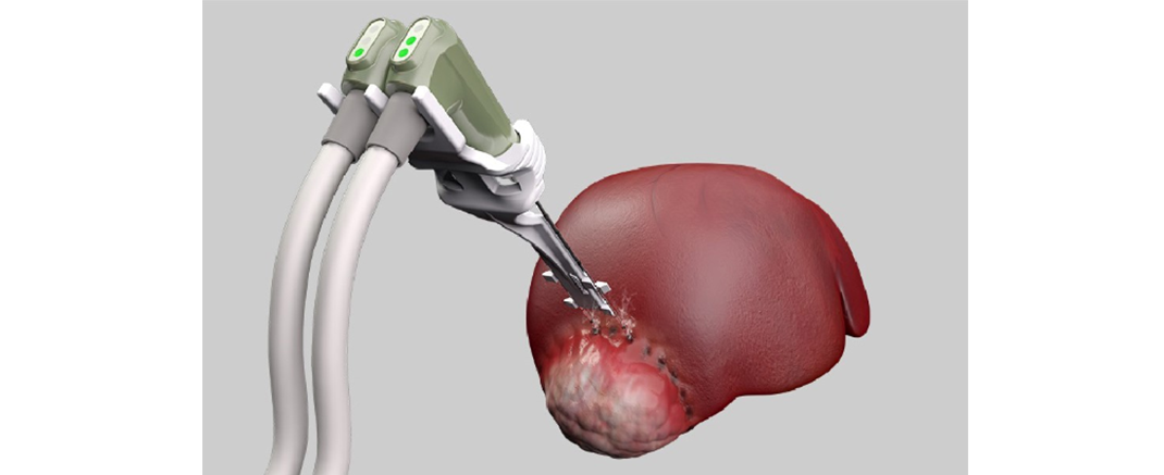 2016 — Aquisição da NEUWAVE Medical
