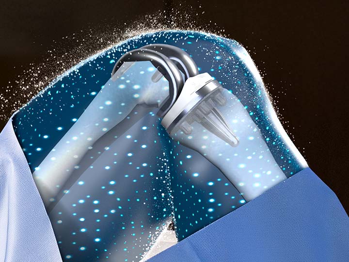 VELYS Enabling Tech with ATTUNE implant for TKA