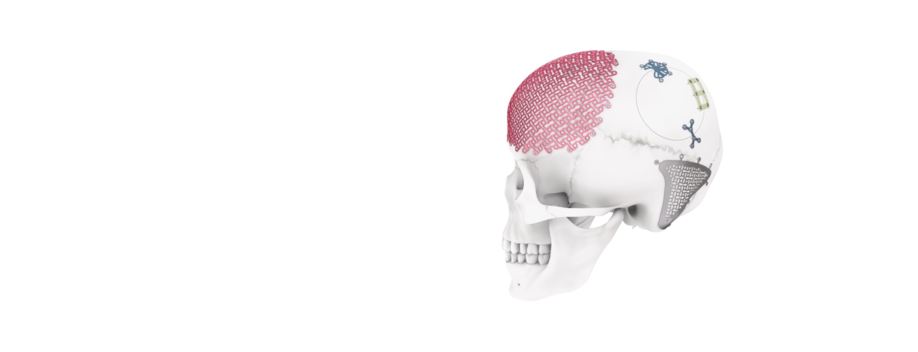 MatrixNEURO shown on a skull