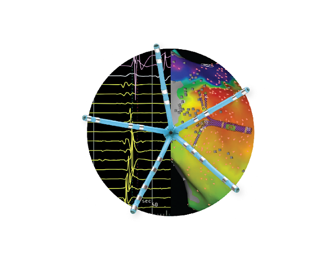 CARTO® PENTARAY™ NAV eco Katheter