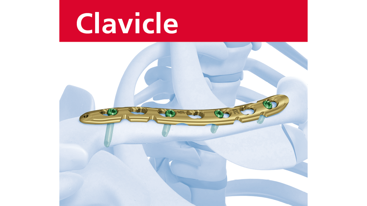 Trauma Research | Trauma Solutions | DePuy Synthes
