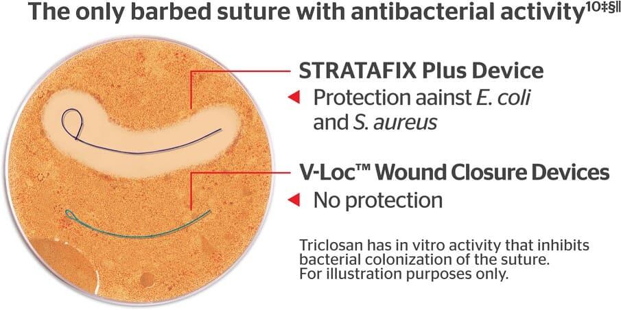 STRATAFIX™ Suture | Knotless Suture | J&J MedTech