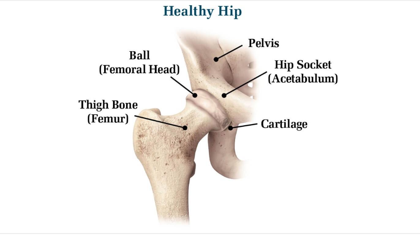 Hip Images | Patient Education Resource | DePuy Synthes