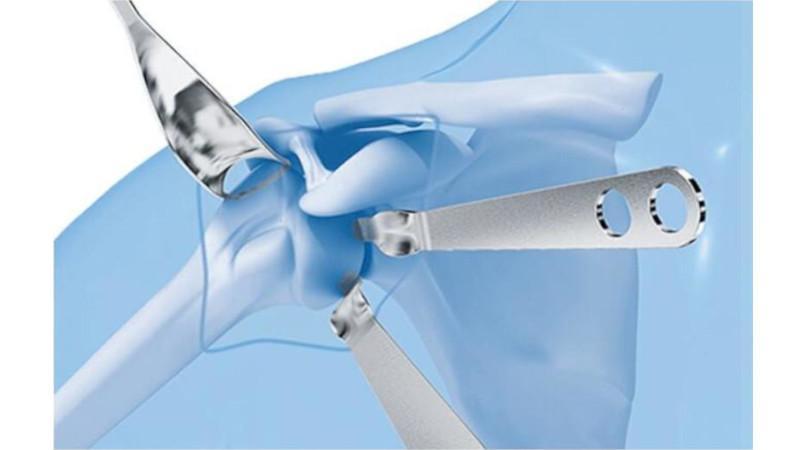 Shoulder instruments retract muscle to expose bone