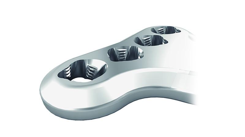 2.4 mm Variable Angle LCP™ Volar Extra-Articular Distal Radius System ...