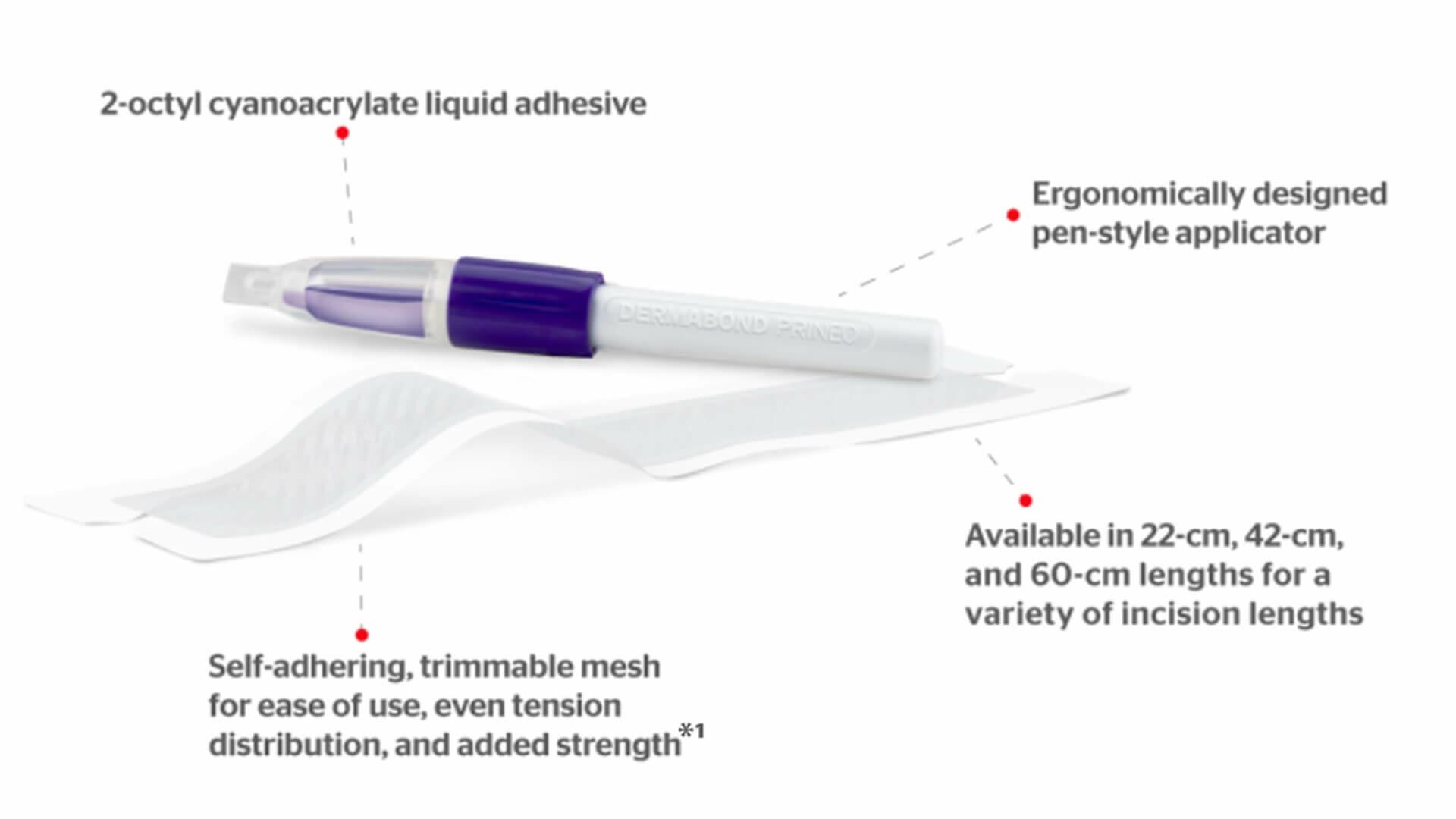 DERMABOND® PRINEO® Skin Closure System