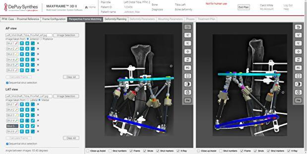 MAXFRAME SOFTWARE