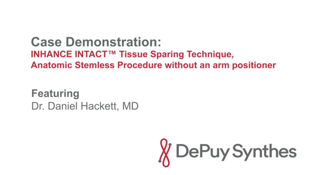 Subscapularis Tissue Sparing Technique Case Demonstration with Dr. Hackett