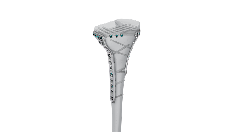 360 Proximal Tibia
