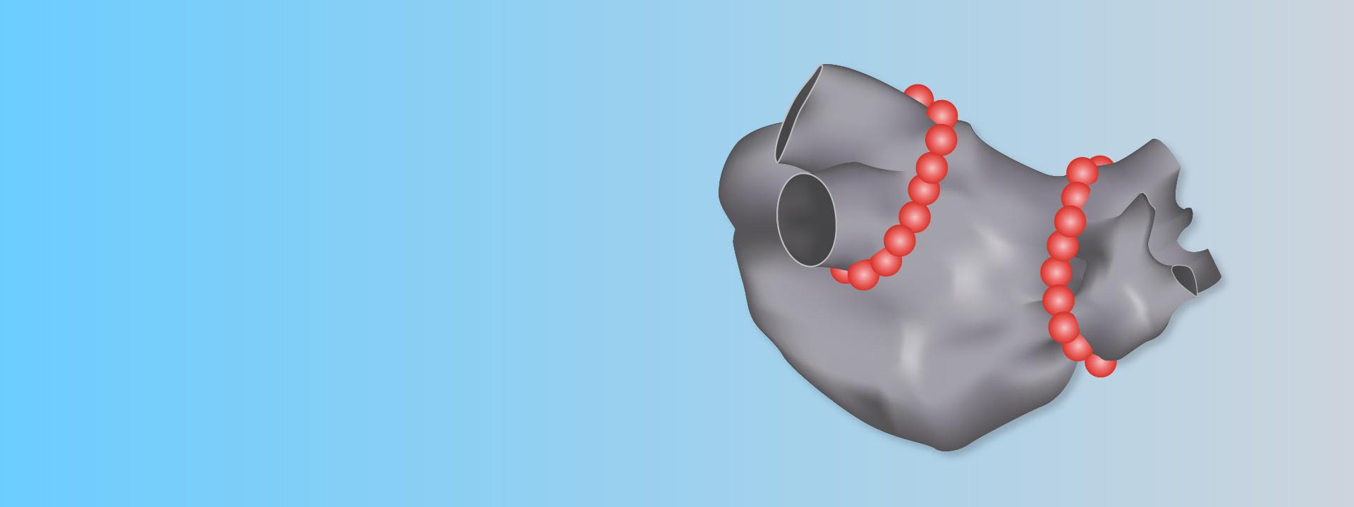 VISITAG SURPOINT ablation tags on left atrial model​