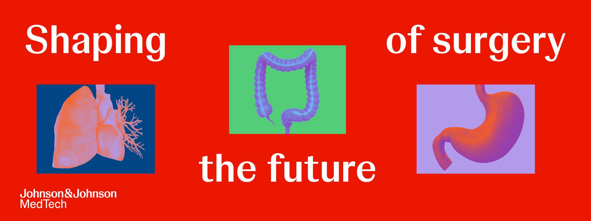 Shaping the future of surgery