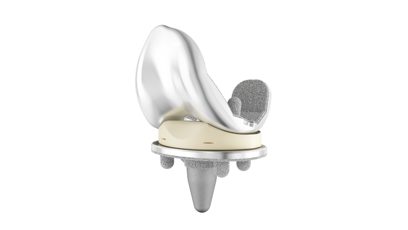 The ATTUNE™ Cementless Knee System assembled with the femoral component and rotating platform tibial base