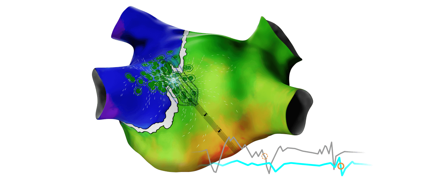 Carto elevate with signals