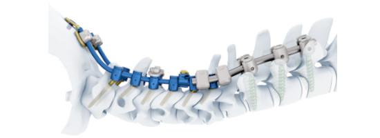 cervical spine system spine image