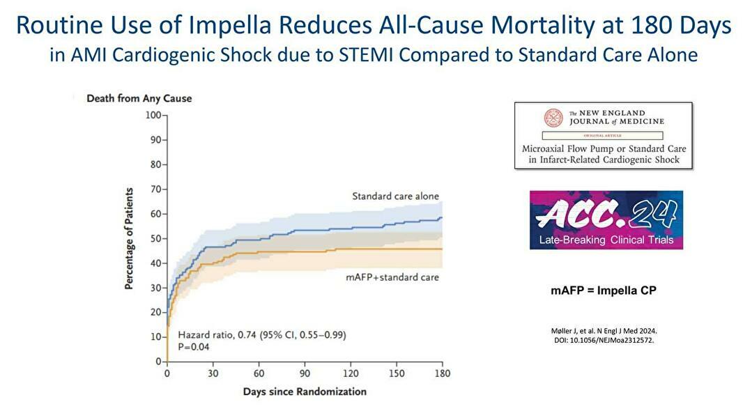 Randomized Controlled Trial Confirms Impella CP® Improves Survival in Heart Attack with Cardiogenic Shock