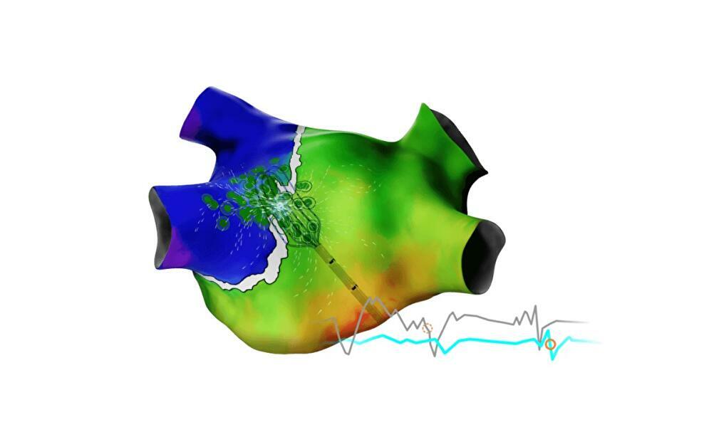Carto elevate with signals