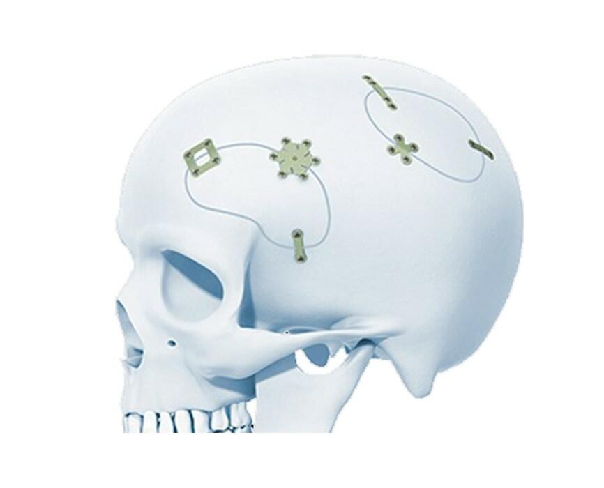 MatrixNEURO™