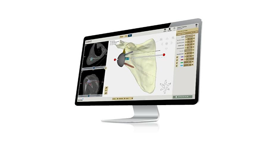 TRUMATCH® Personalised Solutions Shoulder System