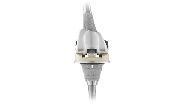 S-ROM® NOILES™ Rotating Hinge Knee System (NRH)