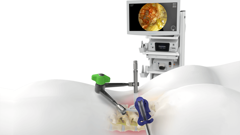 TELIGEN System Procedure