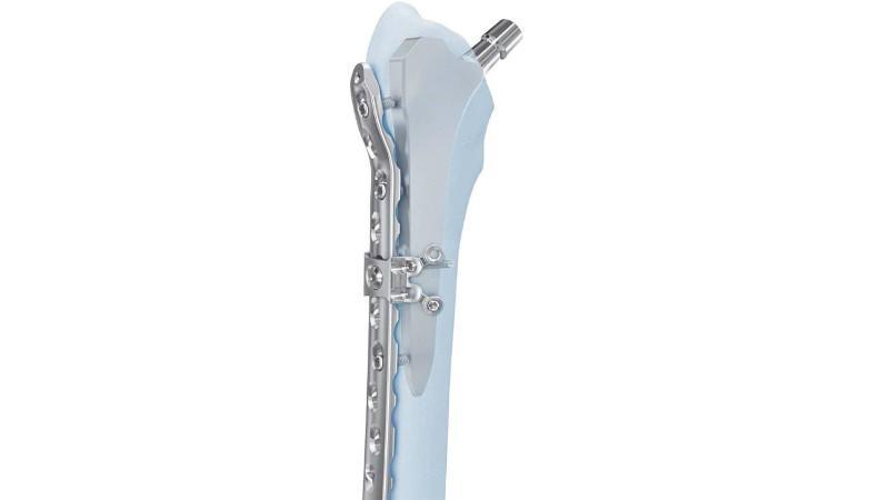The LCP Locking Attachment Plate shown in place attached to bone