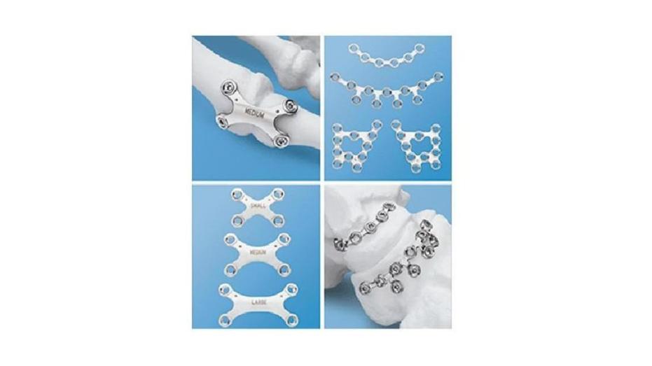 Different modular foot plates shown independently and in bone