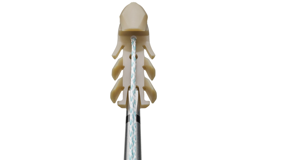 The TIGHT-N™ Tendon Docking Anchor shown up close 
