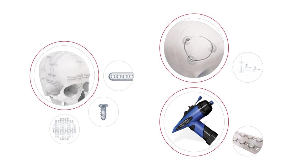 Screw, plate and mesh of the RAPIDSORB Rapid Resorbable Fixation System, RAPIDSORB Rapid Cranial Clamp and Injectable Polymer System shown individually and/or fixated on human skull.