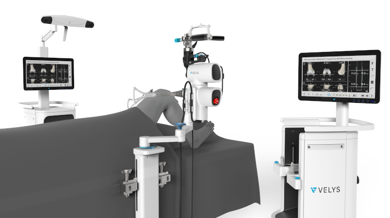 VELYS Robotic-Assisted Solution setup in OR