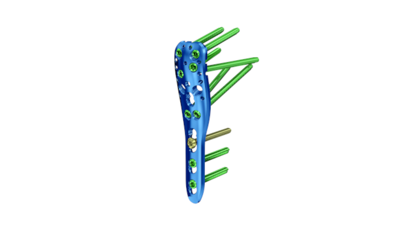 Image of PHILOS