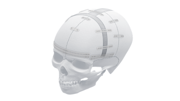 RAPIDSORB™ Resorbable Fixation System