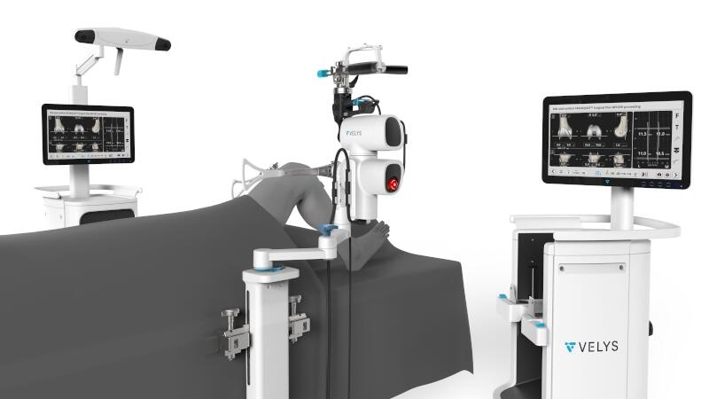 VELYS Robotic-Assisted Solution for TKA setup in OR