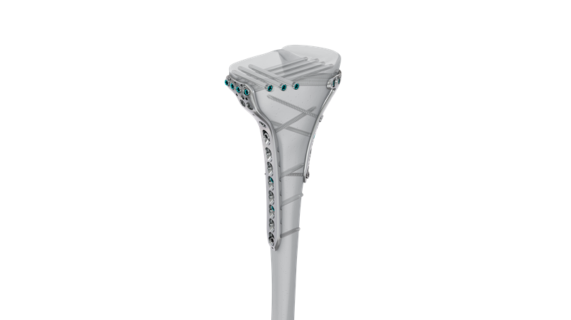 360 Proximal Tibia