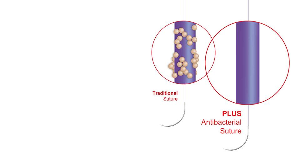 Ethicon’s Plus Sutures 