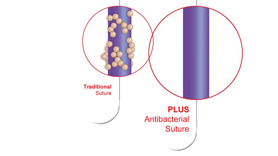 Suture antibatteriche Plus di Ethicon