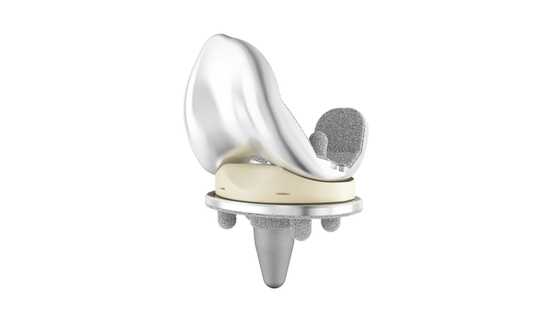 The ATTUNE™ Cementless Knee System assembled with the femoral component and rotating platform tibial base